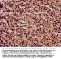 IFT140 Antibody