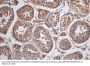 CRBN Antibody