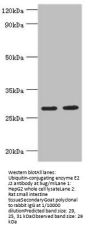 UBE2J2 Antibody