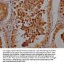 FAM24B Antibody
