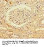 PNPLA1 Antibody