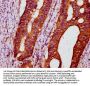 POC5 Antibody