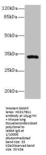 HSD17B11 Antibody