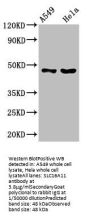 SLC16A11 Antibody