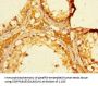 FBXO15 Antibody