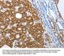 SMARCA4 Antibody