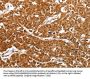 SMARCA4 Antibody