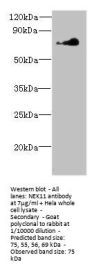 NEK11 Antibody