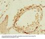 NEK11 Antibody
