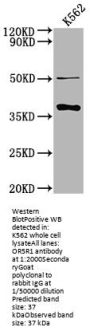 OR5R1 Antibody
