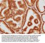 HUS1B Antibody