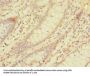 LMO3 Antibody