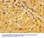 PHLDA1 Antibody