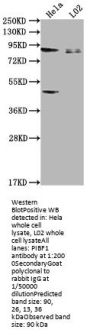 PIBF1 Antibody