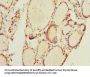 THRSP Antibody