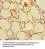 RIT1 Antibody