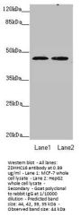 ZDHHC16 Antibody