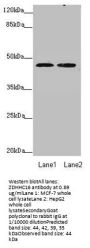 ZDHHC16 Antibody