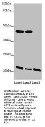 ZDHHC16 Antibody