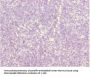 ZDHHC16 Antibody
