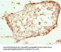 ABCC11 Antibody
