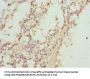 ABCC11 Antibody