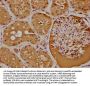 IFT74 Antibody