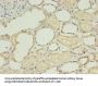 TGS1 Antibody