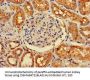 CDK5RAP2 Antibody