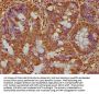 PARP8 Antibody