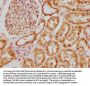 BBS5 Antibody