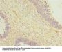 OTUD6B Antibody