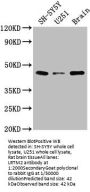LRTM2 Antibody