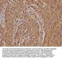 LRTM2 Antibody