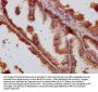 ANKRD42 Antibody