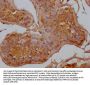 ANKRD42 Antibody