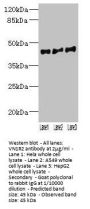 VN1R2 Antibody