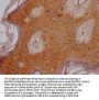 OR6B3 Antibody