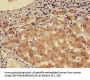 CHD5 Antibody