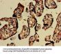 CHD5 Antibody