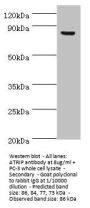 ATRIP Antibody