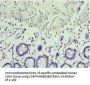 Rabbit anti-human RSAD2 polyclonal Antibody