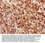 MYO3B Antibody