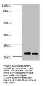 NABP1 Antibody