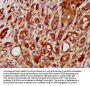 LRRC45 Antibody