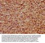 RILP Antibody