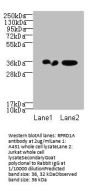 RPRD1A Antibody