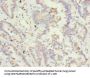 TSSK3 Antibody