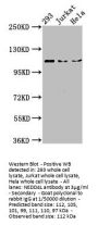 NEDD4L Antibody