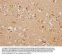 HHIP Antibody